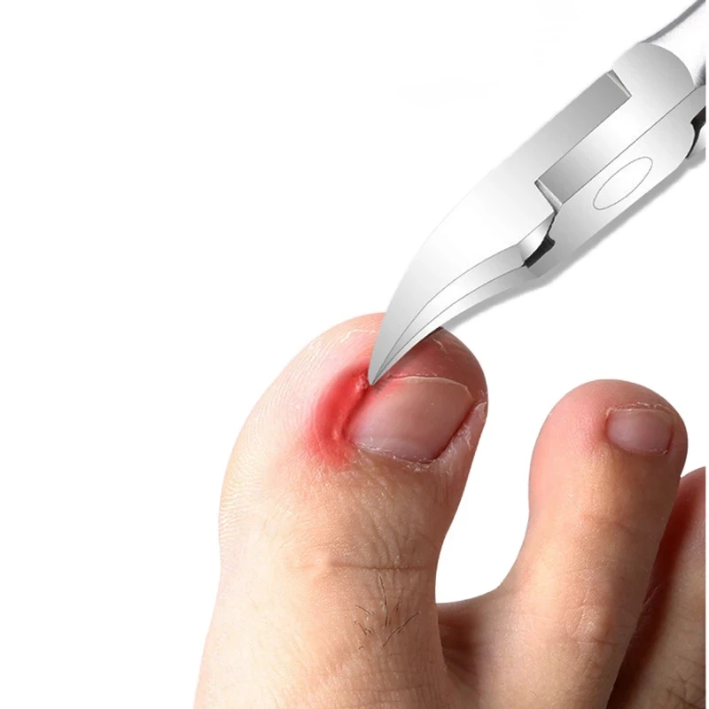 6 шт. набор кусачек для ногтей Маникюрные ножницы для вросших ногтей на ногах Инструмент для профессионального педикюра кусачки для кутикулы резак для удаления кутикулы 3